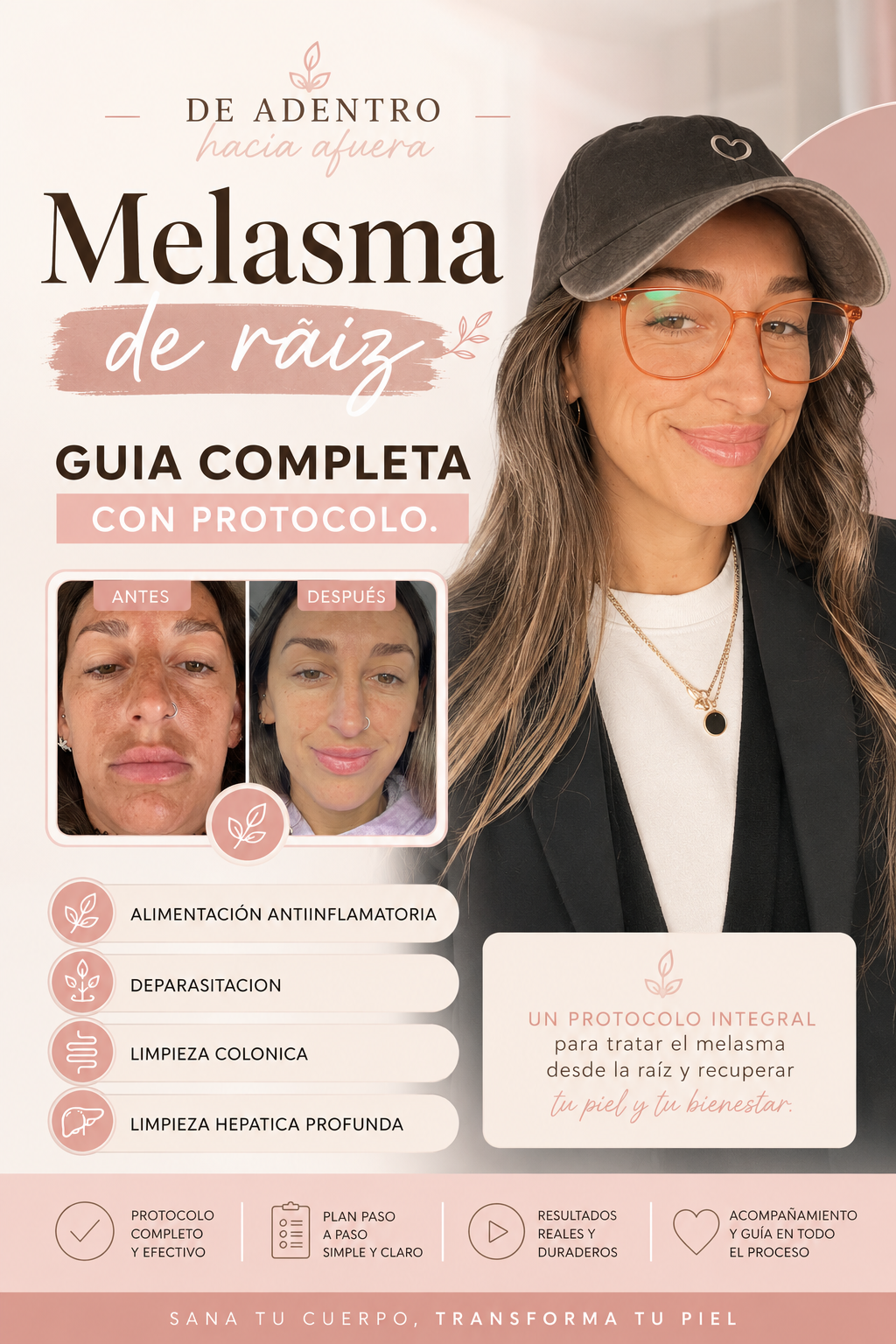Protocolo de Raiz para Tratar el Melasma