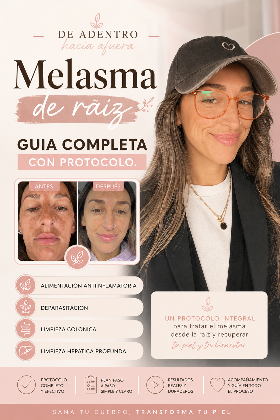 Protocolo de Raiz para Tratar el Melasma
