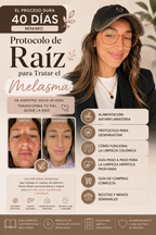 Protocolo de Raiz para Tratar el Melasma